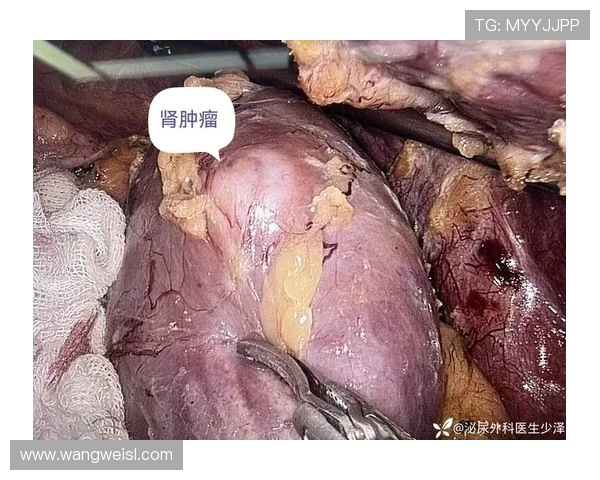 从肾癌病房到商业帝国：韦德如何用三重身份重塑人生(3)